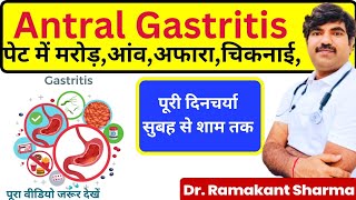 Antral Gastritis Treatment in Hindi  Gastritis Symptoms [upl. by Priest703]