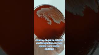 Que es Staphylococcus haemolyticus 🦠 ciencia microbiologia bacteria microbiology bacterias [upl. by Adnarb]