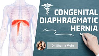 Congenital diaphragmatic hernia CDH types causes mechanism diagnosis amp treatment [upl. by Nnylav735]