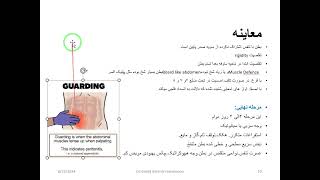 14Peritonitis Types Primary Secondary Tuberclosis Pelvic Abscess [upl. by Nomelihp119]