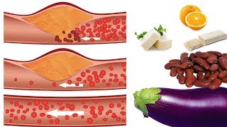 9 Makanan Penurun Kolesterol LDL Tinggi dengan Cepat [upl. by Arinayed]