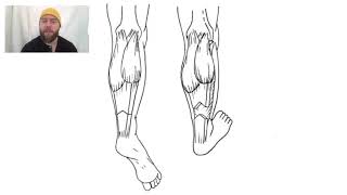 Vulpius amp Stoffel Procedure for Equinus [upl. by Louth]