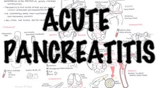 Acute Pancreatitis  Overview signs and symptoms pathophysiology investigations treatment [upl. by Ambrosia537]