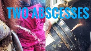 TWO ABSCESSES vlog 316 [upl. by Uella]