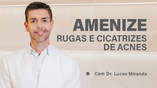 A melhor tecnologia para amenizar rugas e cicatrizes de acne  Morpheus 8® [upl. by Willem]