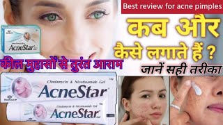 Acnestar gel for acne pimples कील मुंहासों से तुरंत आराम असरदार दवाई youtubeviralvideo ytvideo [upl. by Ardella]