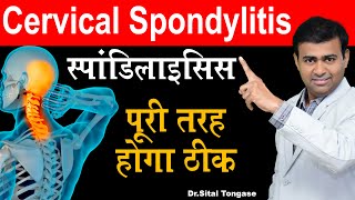 स्पॉन्डिलाइटिस पूरी तरह होंगा ठीक I Cervical Spondylosis  Cervical Exercise [upl. by Nahtal]