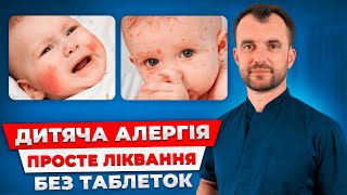 День 3 Алергія у дитини пройде НАЗАВЖДИ Правильне лікування алергії у дитини без таблеток [upl. by Mapel]