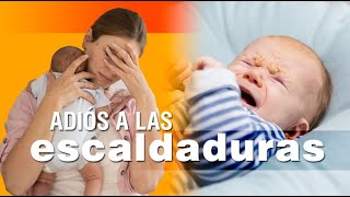 Las escaldaduras en los bebés  síntomas causas y soluciones [upl. by Lowrie]