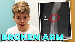 11 YEAR OLD BREAKS ARM AT FRIENDS HOUSE  FIRST BROKEN ARM  FIRST BROKEN BONE  TERRIBLE TIMING [upl. by Capps983]