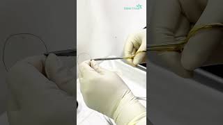 Biopsy for histopathology  Dhaka Dermatology Institute  LaserTreat [upl. by Bortman]