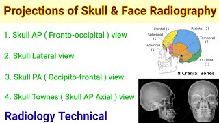 Projection of Skull amp Face Radiography [upl. by Nole]