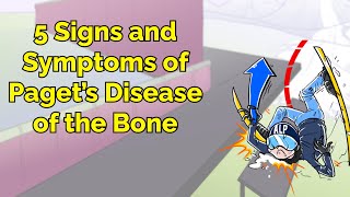 5 Signs and Symptoms of Paget’s Disease of the Bone Step 1 COMLEX NCLEX® PANCE AANP [upl. by Onafets983]