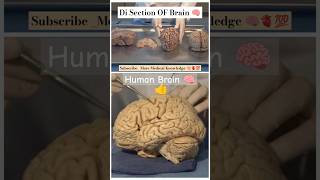 humanBrain 🧠Part 01🧠description details 👇🧠💯anatomy🧠 medicalmbbsdoctor brain🧠neet science [upl. by Eimas]