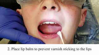 8 Fluoride Varnish Tips with Pulpdents Embrace Varnish [upl. by Notneiuq183]