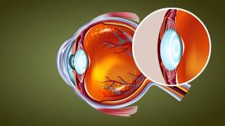 Human Eye  Class 10 Tutorial [upl. by Robma]