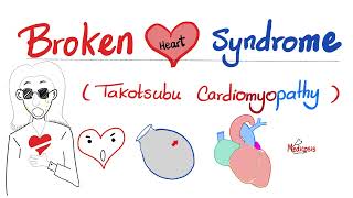 Broken Heart 💔 Syndrome Takotsubo cardiomyopathy  Cardiology Series [upl. by Annyrb]