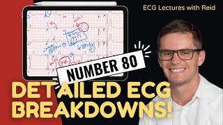 EKG Test Yourself  ECG Case Study 80 [upl. by Beatriz]