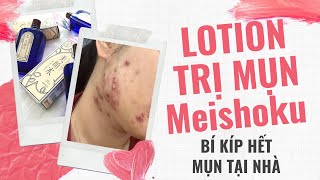 Lotion Trị Mụn Meishoku Bigansui  Cách Sử Dụng amp Review Chi Tiết [upl. by Mirelle]