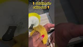 Solution for calluses on feet 🦶 healthyhabits youtubecreatorawards [upl. by Kreindler]