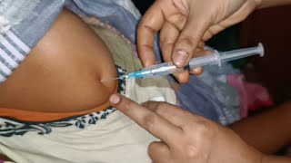 IM Intramuscular Arm injection Push Hydrocortisone  Cotson  injection 24 Ep 99 Anik Health Tips [upl. by Veedis]