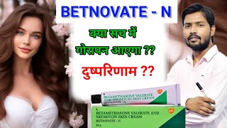 Betnovate n Cream honest review  Betnovate n lagane se kya hota hai  Betnovate n skin cream  aqh [upl. by Aldon]