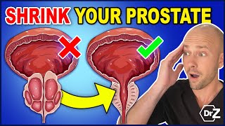 How To Fix An Enlarged Prostate  Shrink YOUR Prostate [upl. by Shellans]