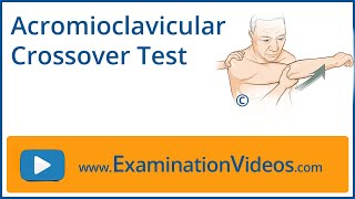 Acromioclavicular Crossover Test [upl. by Oderfliw922]