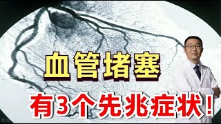 血管堵塞会形成心梗、脑梗，有3个先兆症状！心血管医生却说：每一个都足以致命！ [upl. by Anerev379]