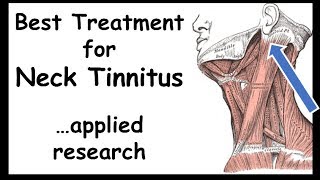 Best Treatment for NeckTinnitus  Somatictype [upl. by Harmonia]