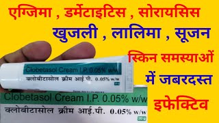 Clobetasol Cream IP Uses in Hindi  क्लोबिटासोल क्रीम के उपयोग [upl. by Elik]