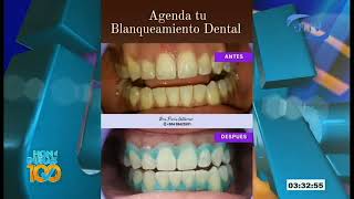 Procedimiento para Blanqueamiento Dental [upl. by Orth]