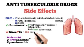 anti tuberculosis drugs side effects [upl. by Nisotawulo]