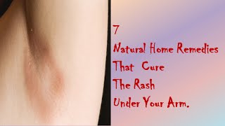 7 Natural Home Remedies That Cure The Rash Under Your Arm [upl. by Gagnon607]