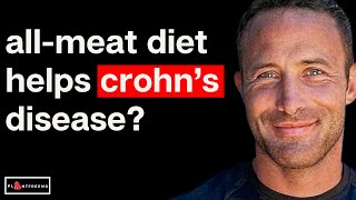 🔴 What Happens To Crohns Disease On a Carnivore Diet [upl. by Ahsiele]