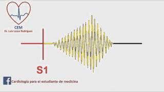 Soplo de la estenosis aortica [upl. by Ximena]