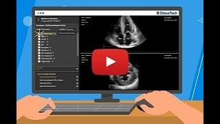 Transforming Imaging Workflows with FHIR  CitiusTechs Integrated Viewer [upl. by Eden]