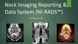 Neck Imaging Reporting and Data System NIRADS Introduction [upl. by Solohcin89]