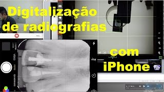 Digitalização de Radiografias  Parte 1 [upl. by Annahvas]