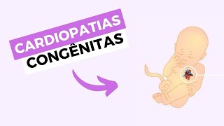 Cardiopatias congênitas CIANÓTICAS e ACIANÓTICAS  cardiopediatria [upl. by O'Donnell]