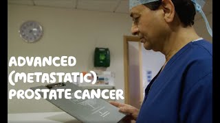 About Advanced Metastatic Prostate Cancer [upl. by Veronique]