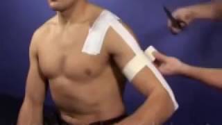 AC acromioclavicular Joint Taping Technique [upl. by Airenahs]