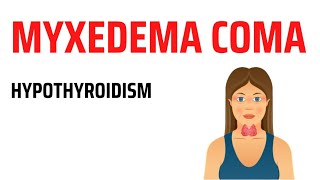 Myxedema Coma  Hypothyroidism [upl. by Deana888]