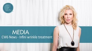 Wrinkle treatment with Radiofrequency microneedling INFINI [upl. by Elleda]