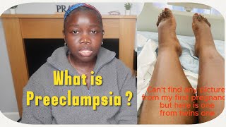 What is Preeclampsia My Story [upl. by Etnaud]