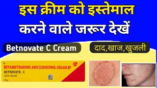 Betnovate c skin cream review  Betnovate c lagane se kya hota hai [upl. by Cohl730]