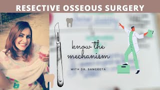 resective osseous surgery in periodontics [upl. by Symons298]