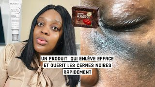 COMMENT ENLEVER  ÉCLAIRCIR ET FAIRE DISPARAÎTRE LES CERNES NOIRS RAPIDEMENT  Angele DE GIDES [upl. by Favrot581]