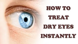 Dry Eyes Cure  How to Cure Dry Eyes Naturally  Dry Eyes Treatment [upl. by Cary]