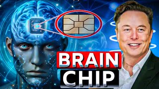 Neuralink Brain Chip  Neuralink Chip Explained in Hindi [upl. by Oettam]